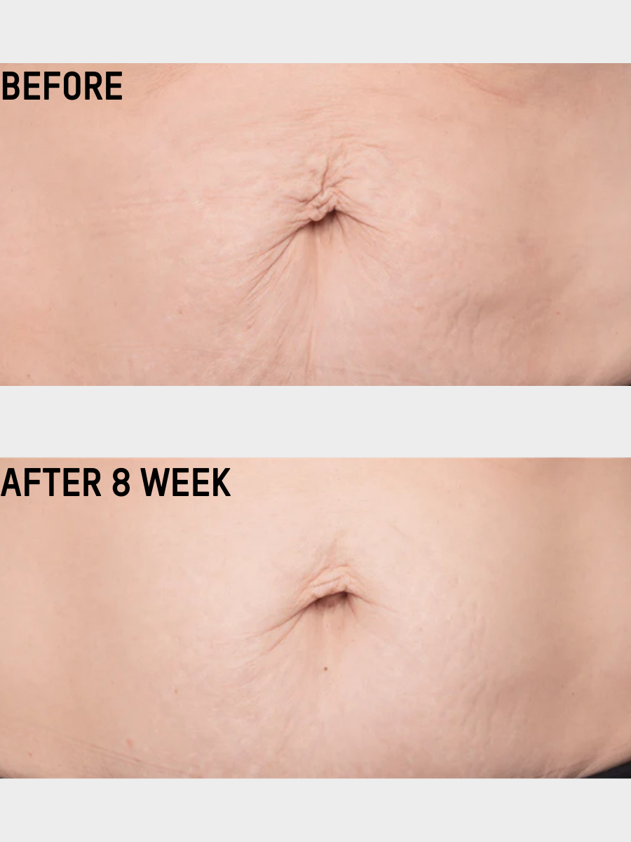 Smooth & Tighten Belly Cream