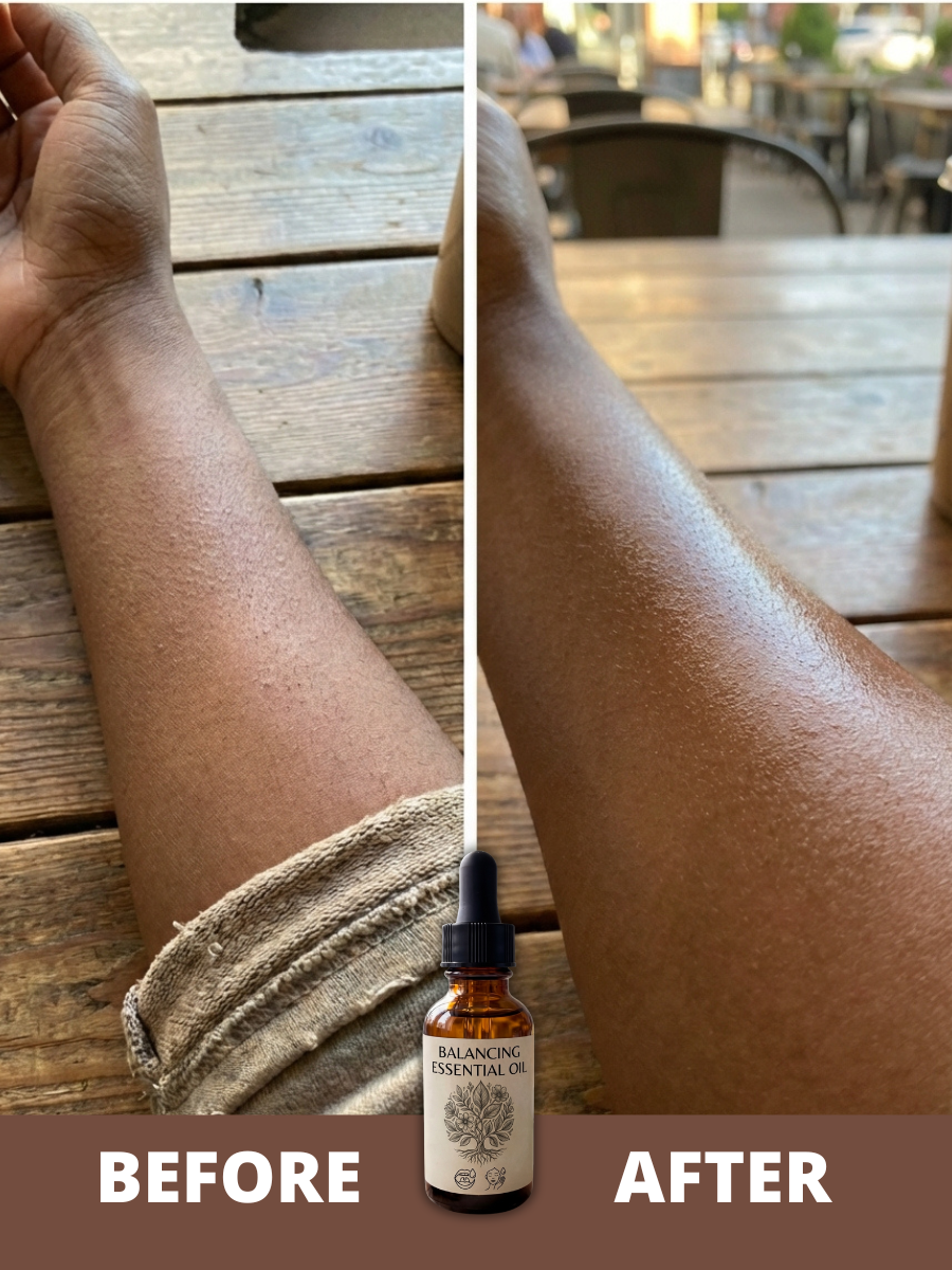 Balancing Essential Oil-(SKIN)
