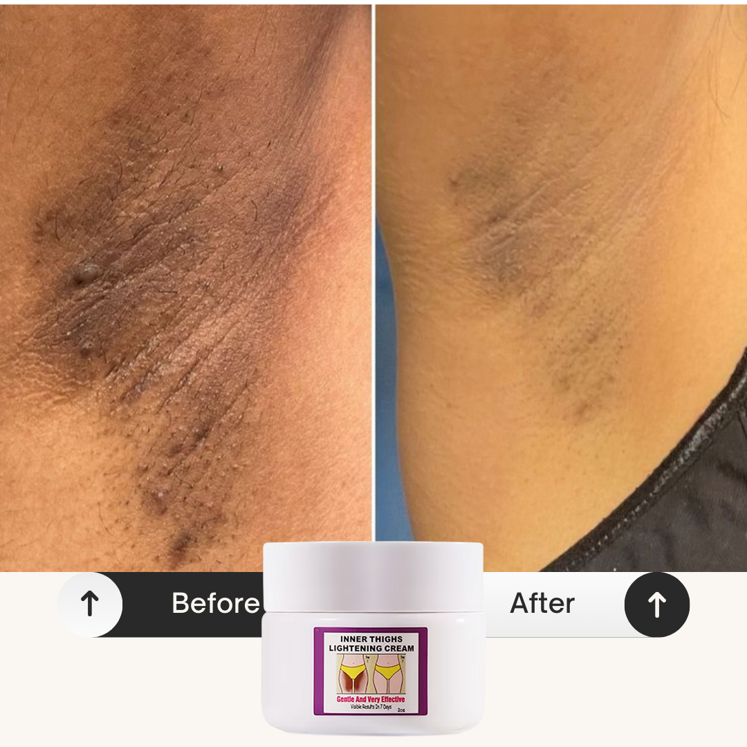 Crema aclaradora para la parte interna de los muslos