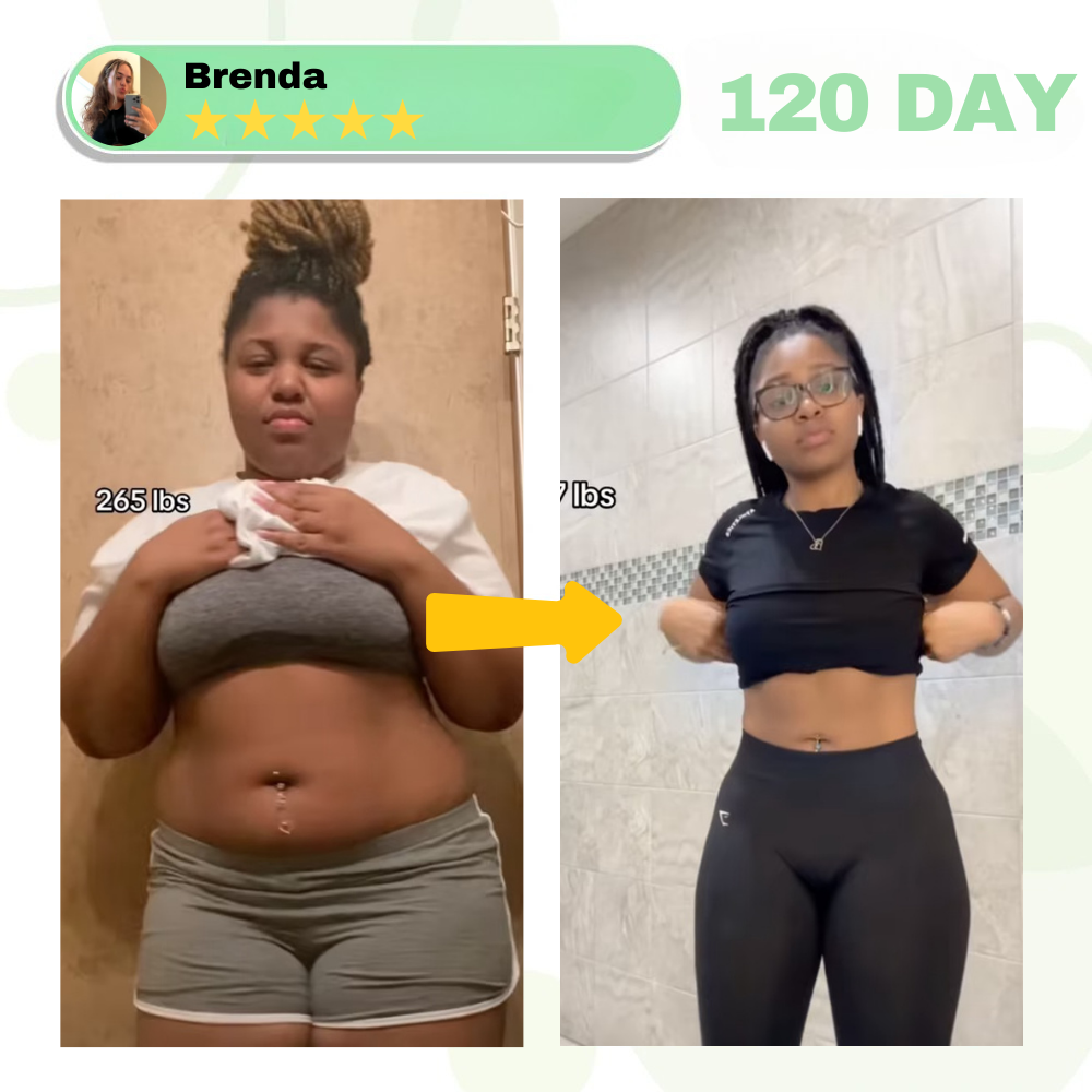 Parche de nanomicroagujas SMGT-GLP-1