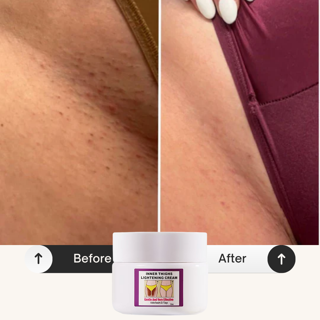 Crema aclaradora para la parte interna de los muslos