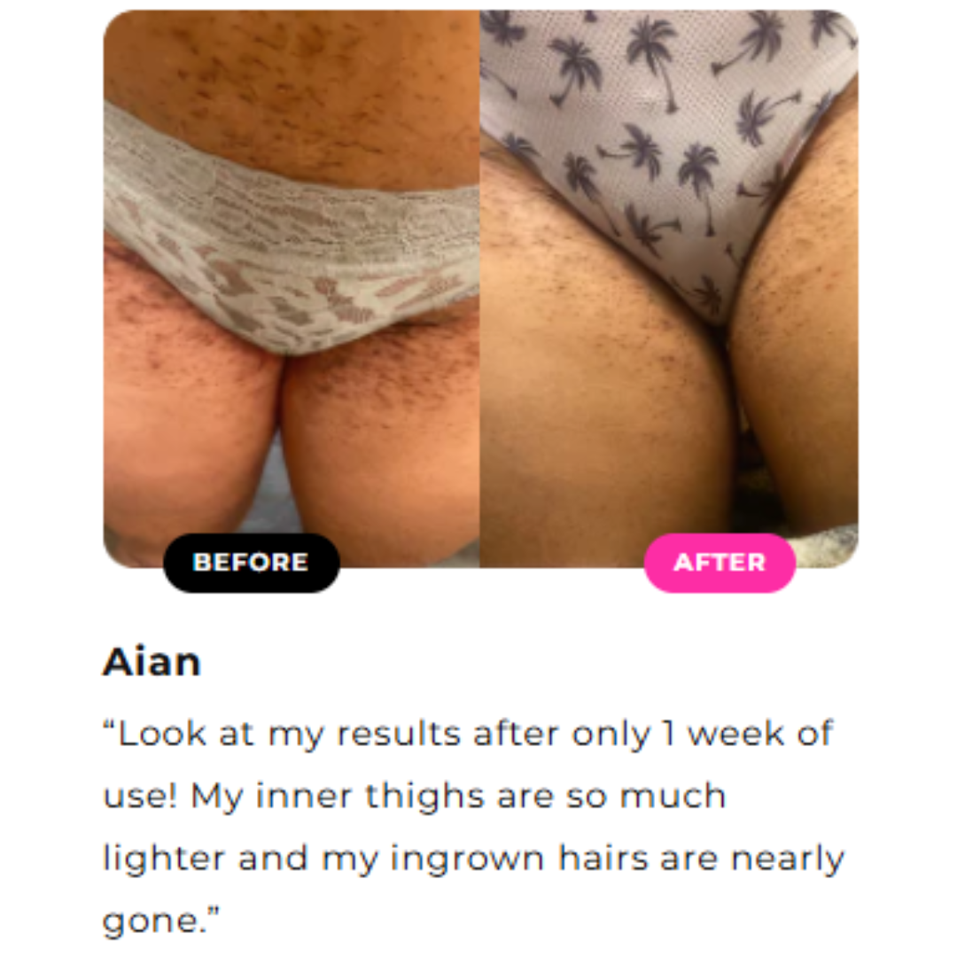 Crema aclaradora para la parte interna de los muslos