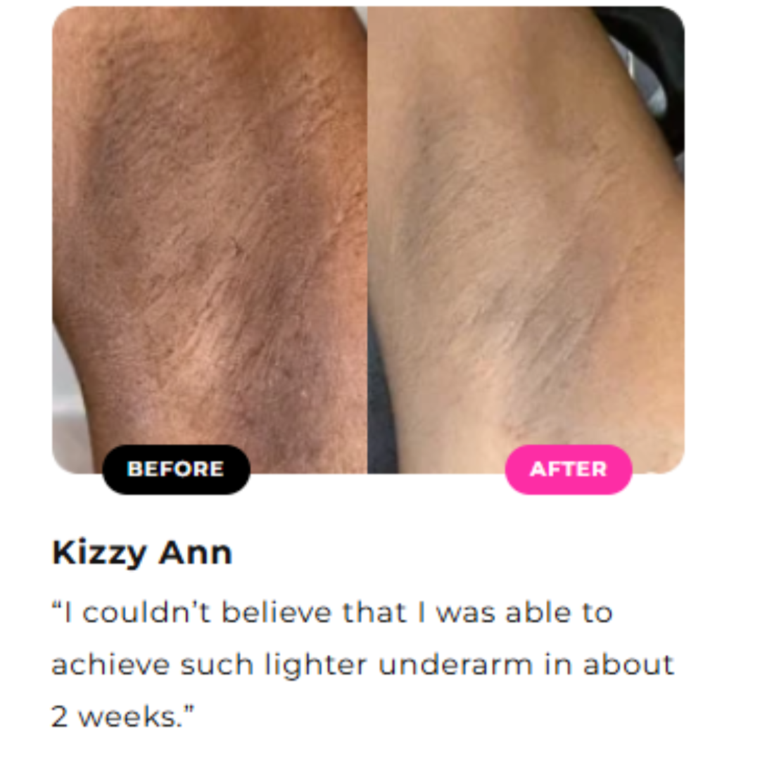 Crema aclaradora para la parte interna de los muslos