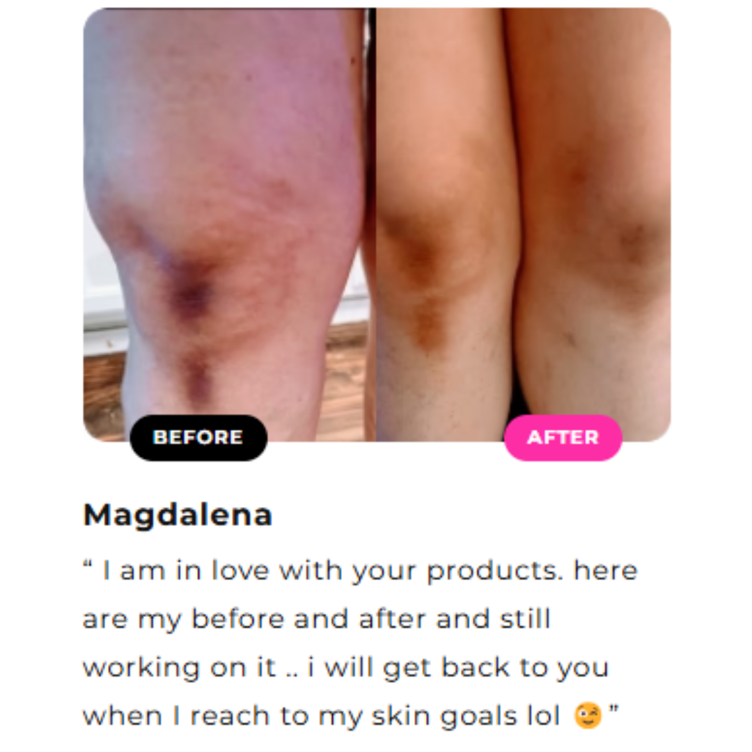 Crema aclaradora para la parte interna de los muslos