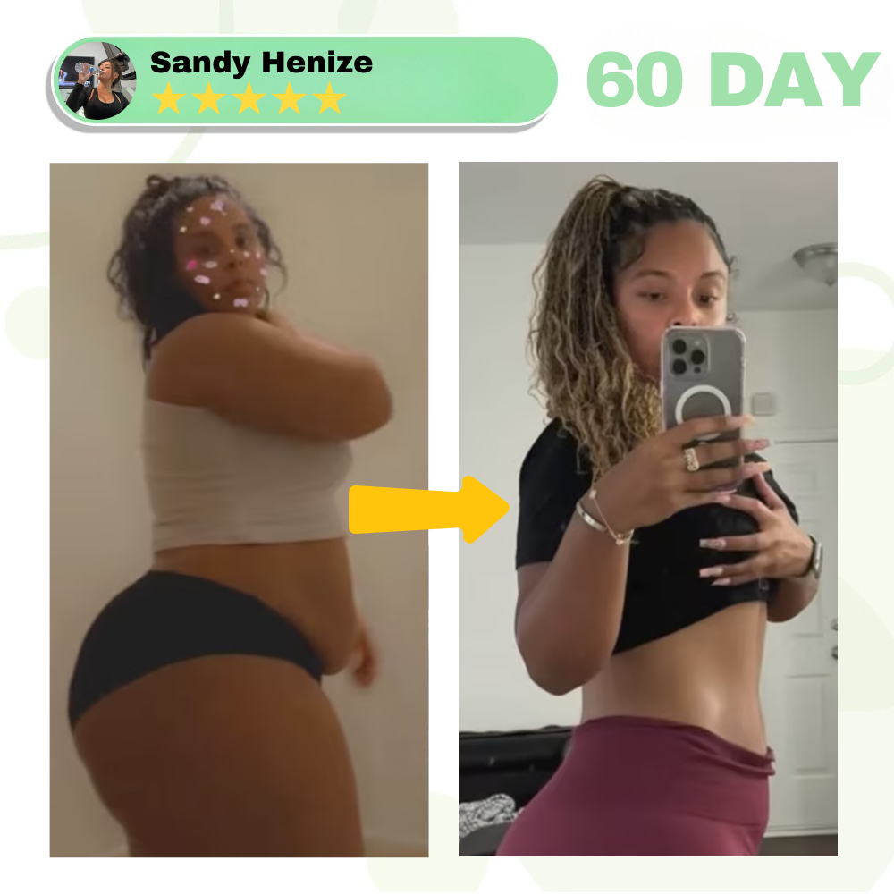 Parche de nanomicroagujas SMGT-GLP-1