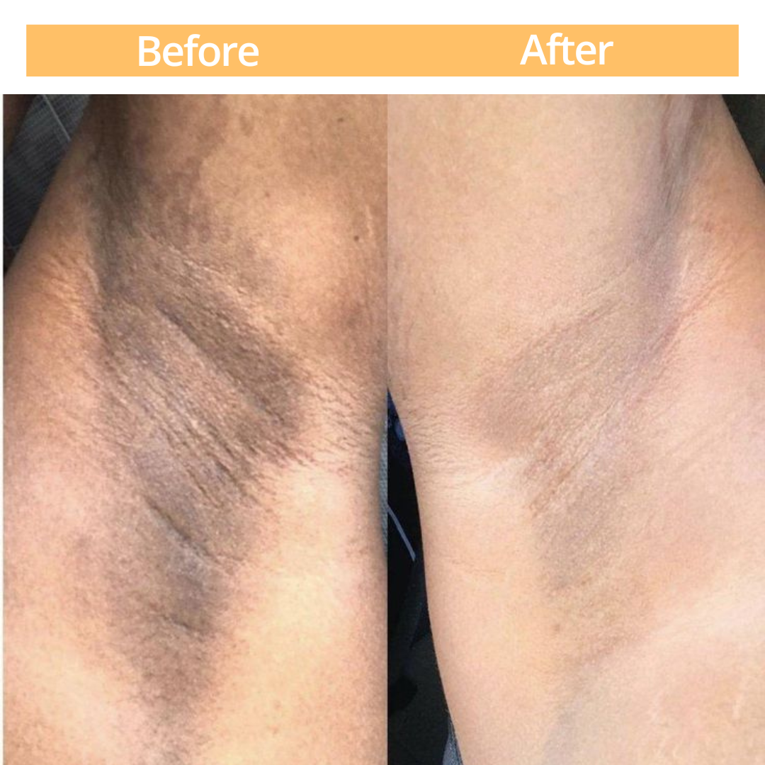 Gel Peeling SCULPT TOUCH - Elimina las manchas oscuras en piernas y axilas