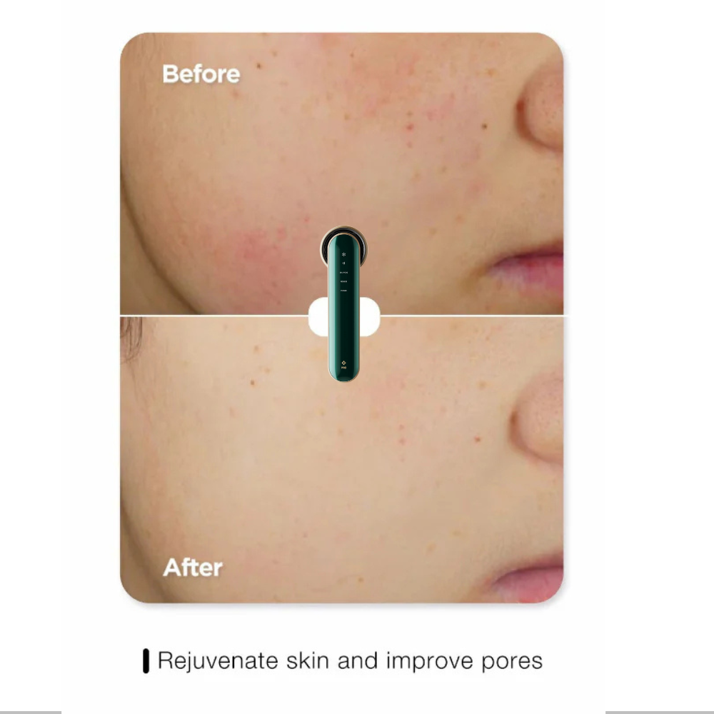 Pro-Grade Skin Repair Device