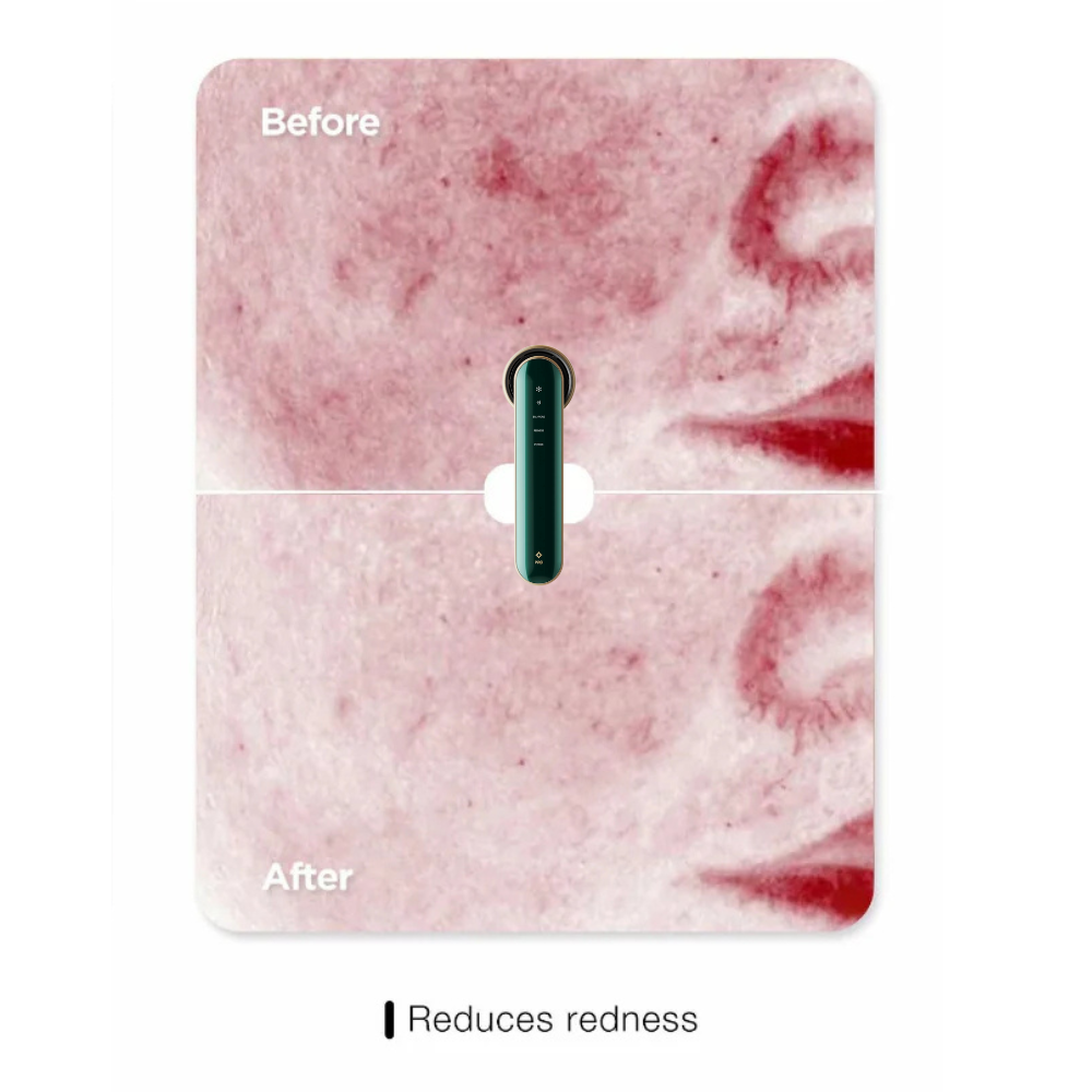 Pro-Grade Skin Repair Device