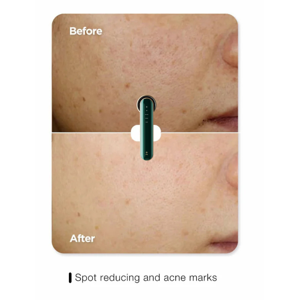 Pro-Grade Skin Repair Device