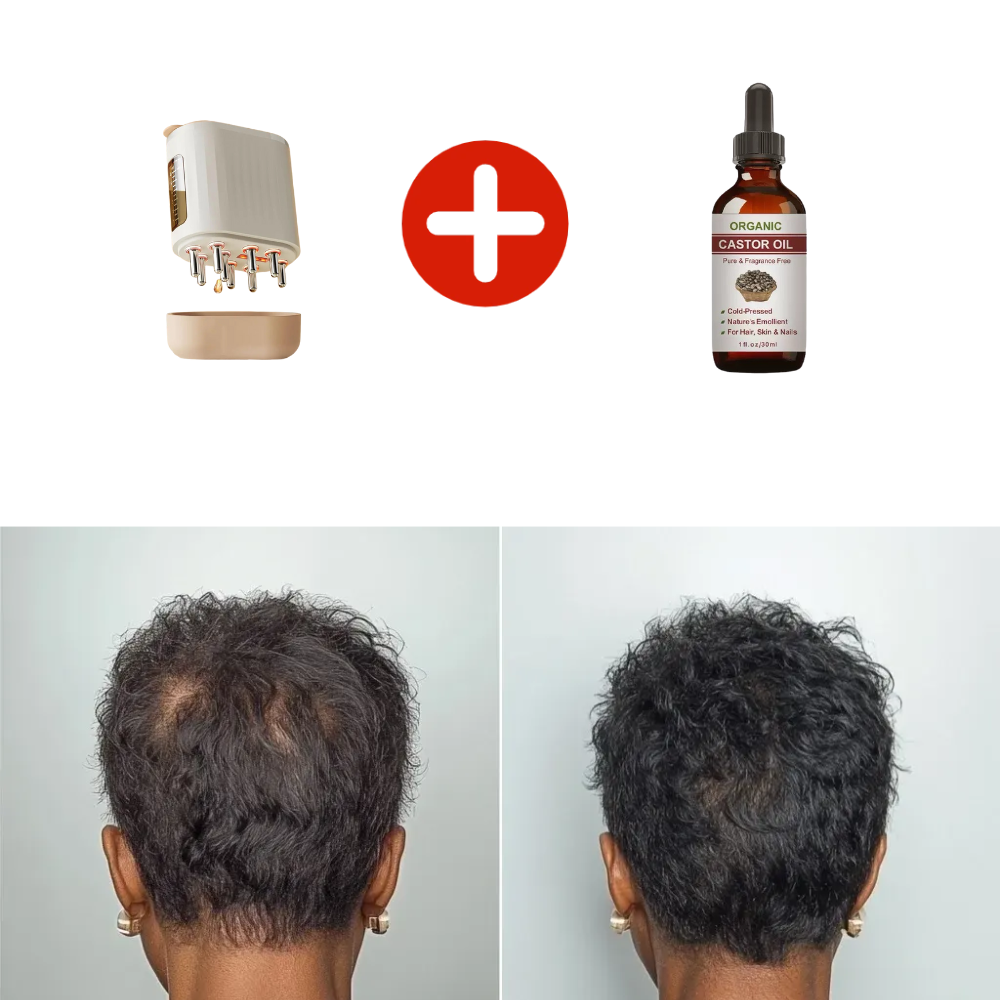 Laser Scalp Therapy Comb