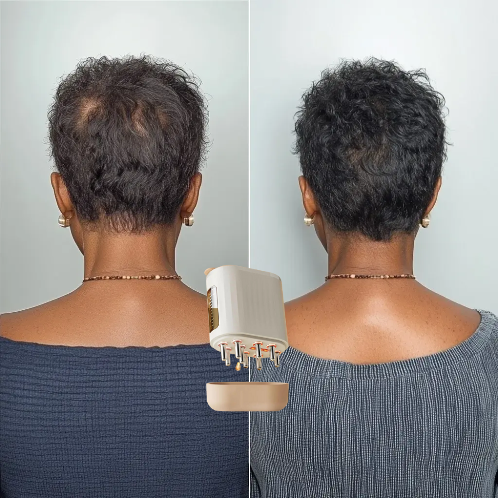 Laser Scalp Therapy Comb