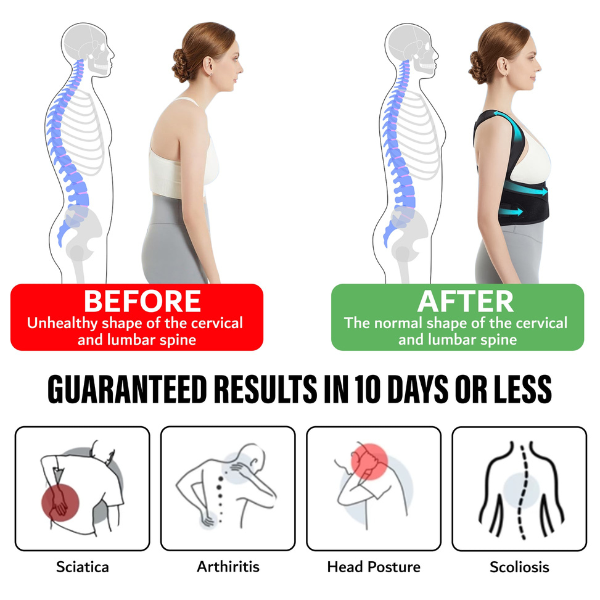 Instant Posture Corrector