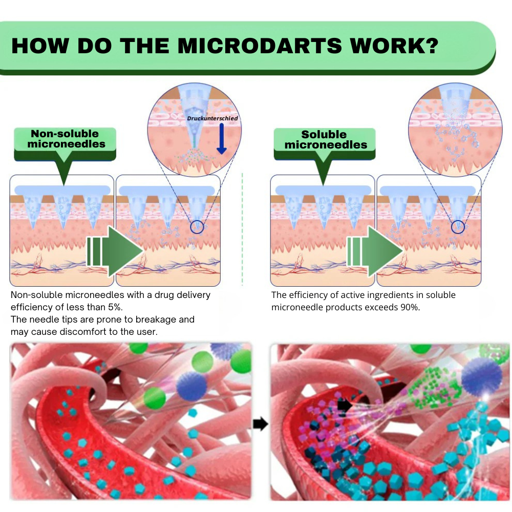 Parche de nanomicroagujas SMGT-GLP-1