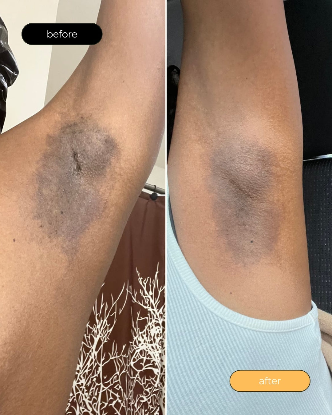 Turmeric Dark Spot Assasin Scrub - Sculpt Touch Official