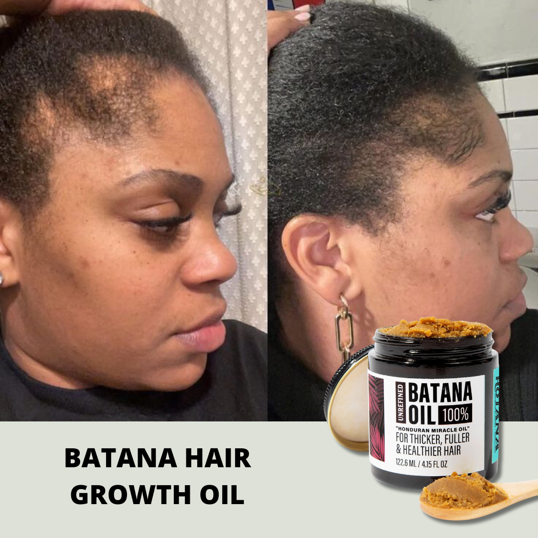 Batana Hair Growth Oil