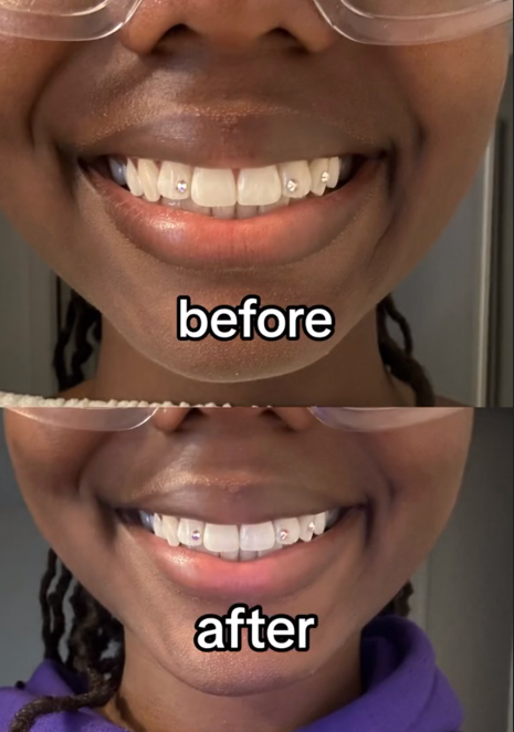 Niacinamide Whitening Toothpaste