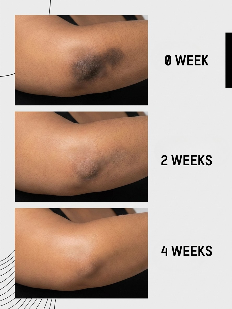 Even Tone Repair Balm