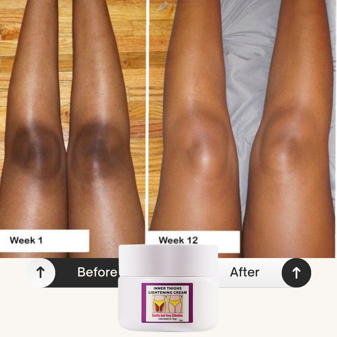 Inner Thighs Lightening Cream