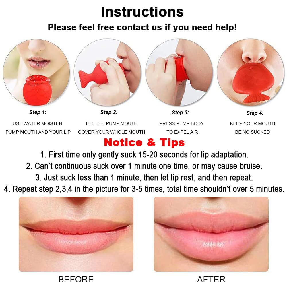 Lips Enhancer Device