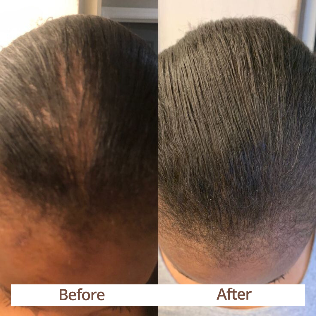 Rosemary Hair Growth Oil