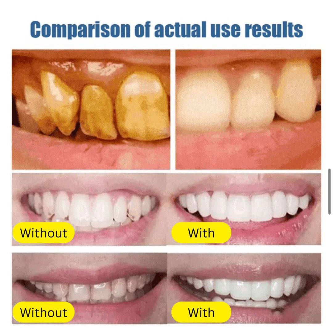 Niacinamide Whitening Toothpaste