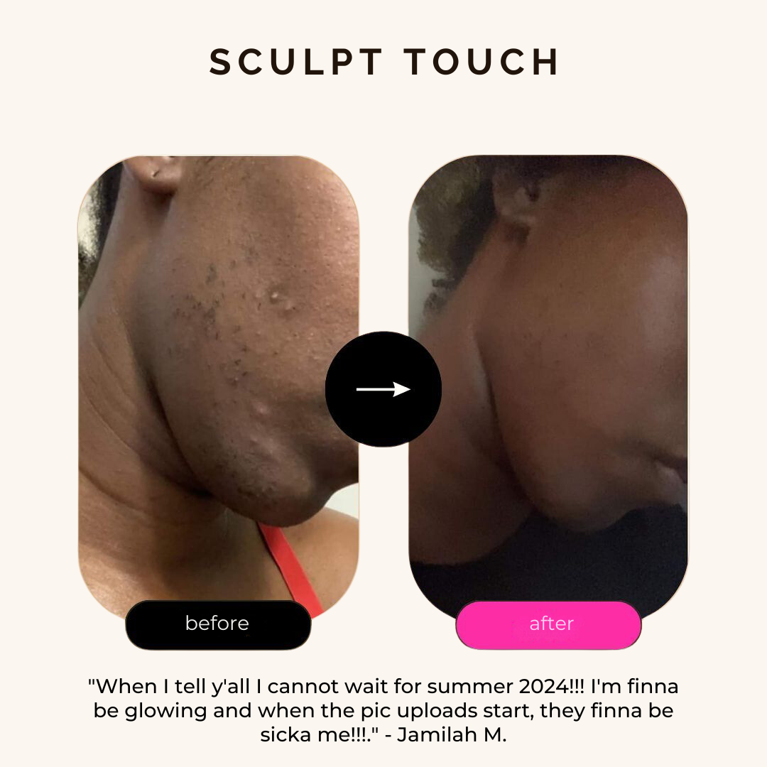 Turmeric Dark Spot Assasin Scrub - Sculpt Touch Official